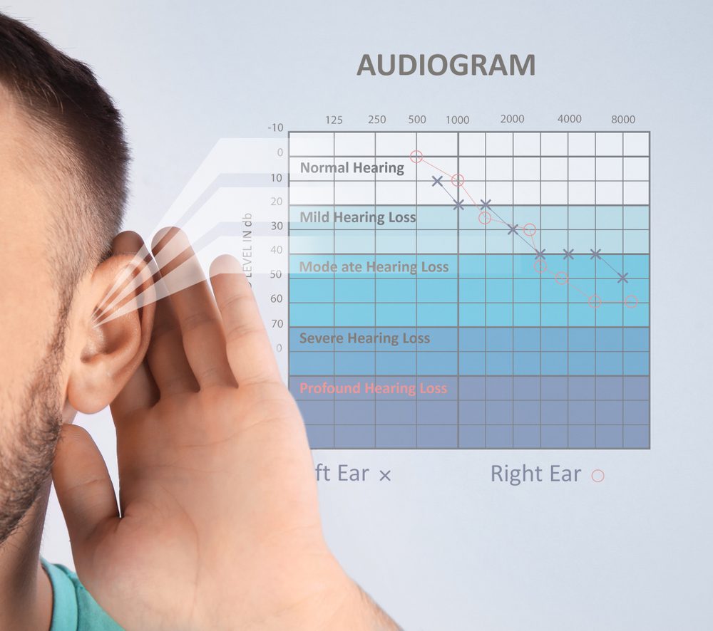 Audiometry